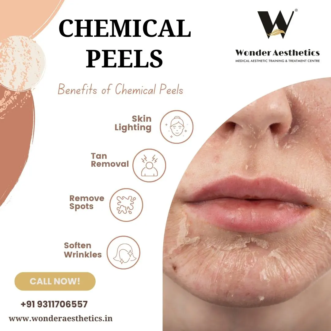 Rejuvenate Your Skin with Advanced Chemical Peels in East Delhi