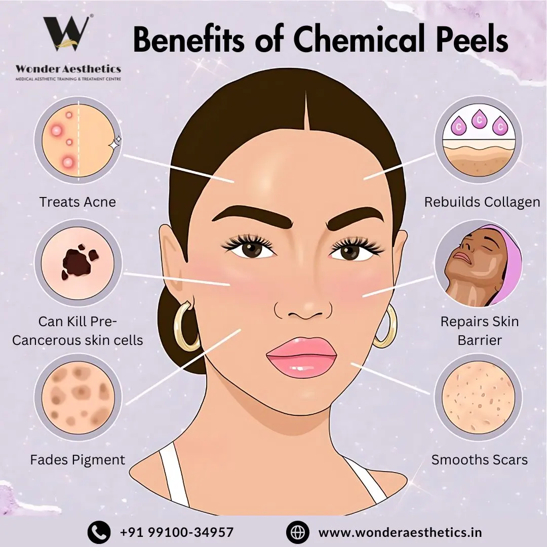 Elevate Your Expertise with Advanced Chemical Peel Training at Wonder Aesthetic